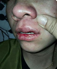 Victim with injuries